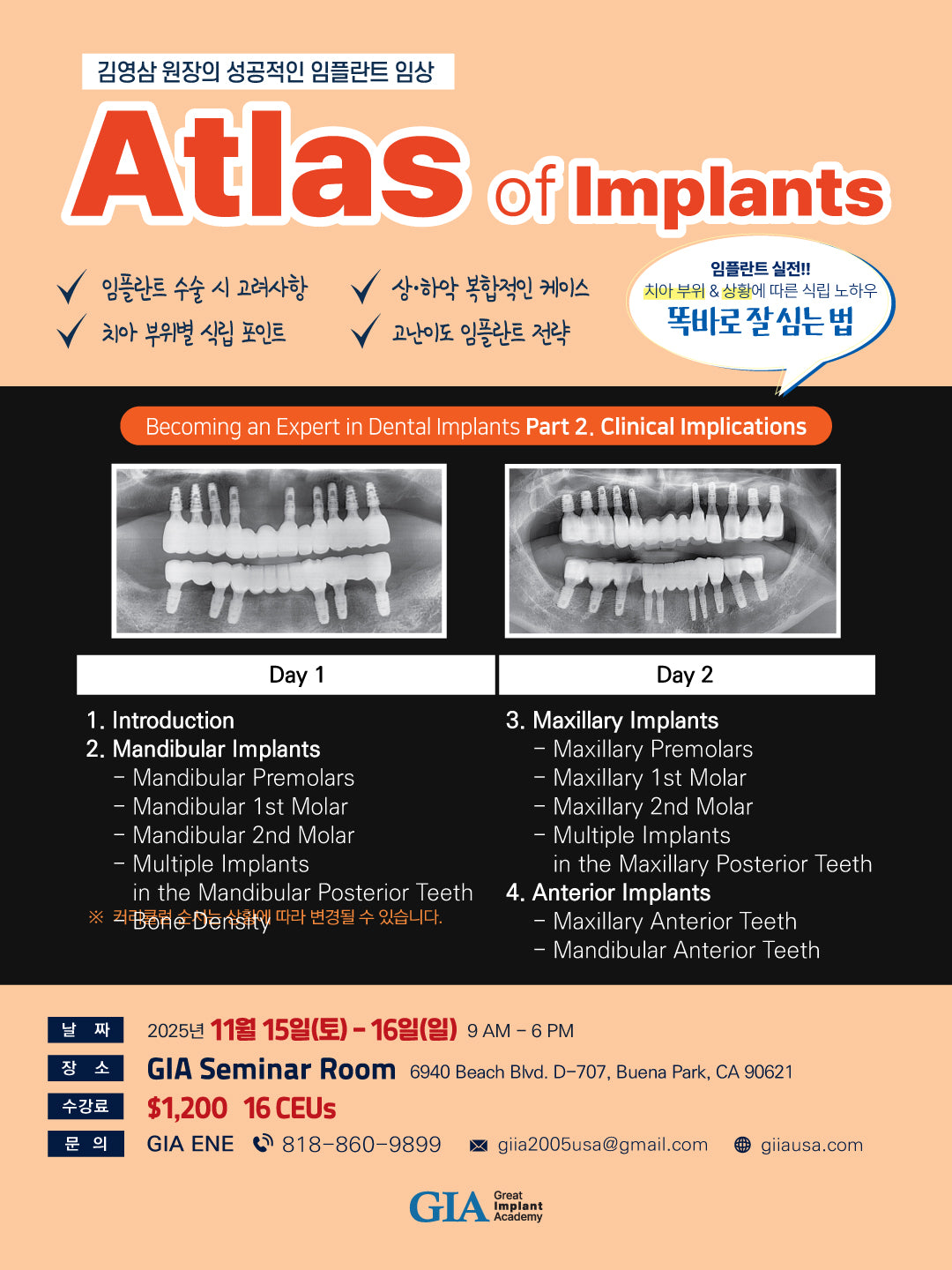 Los Angeles) Atlas of Implants