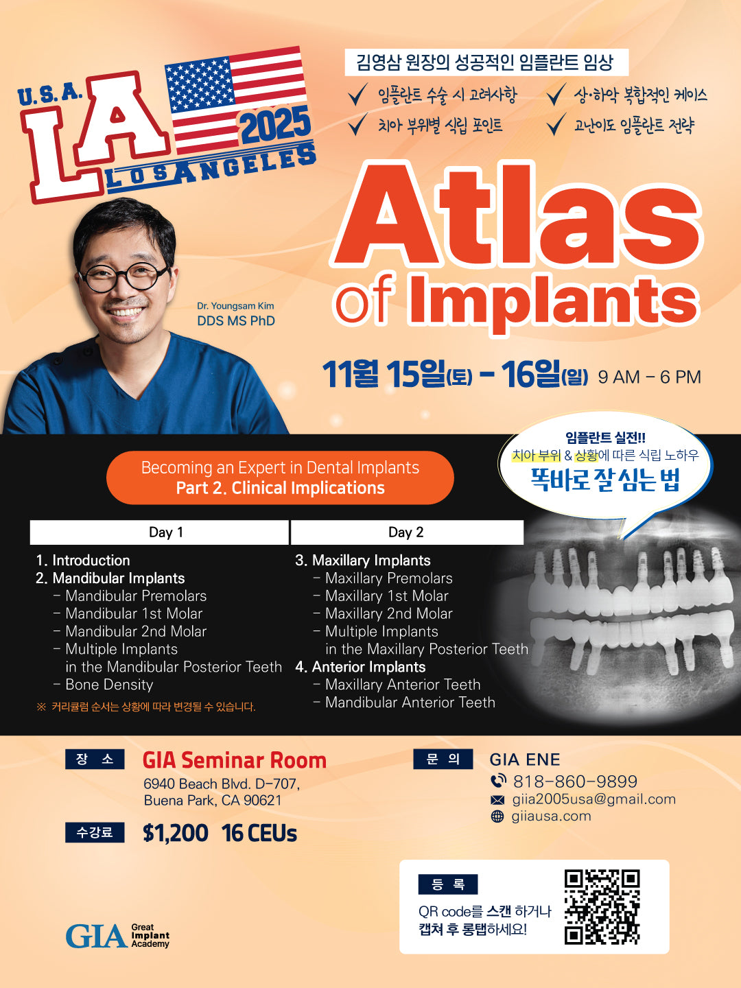 Los Angeles) Atlas of Implants