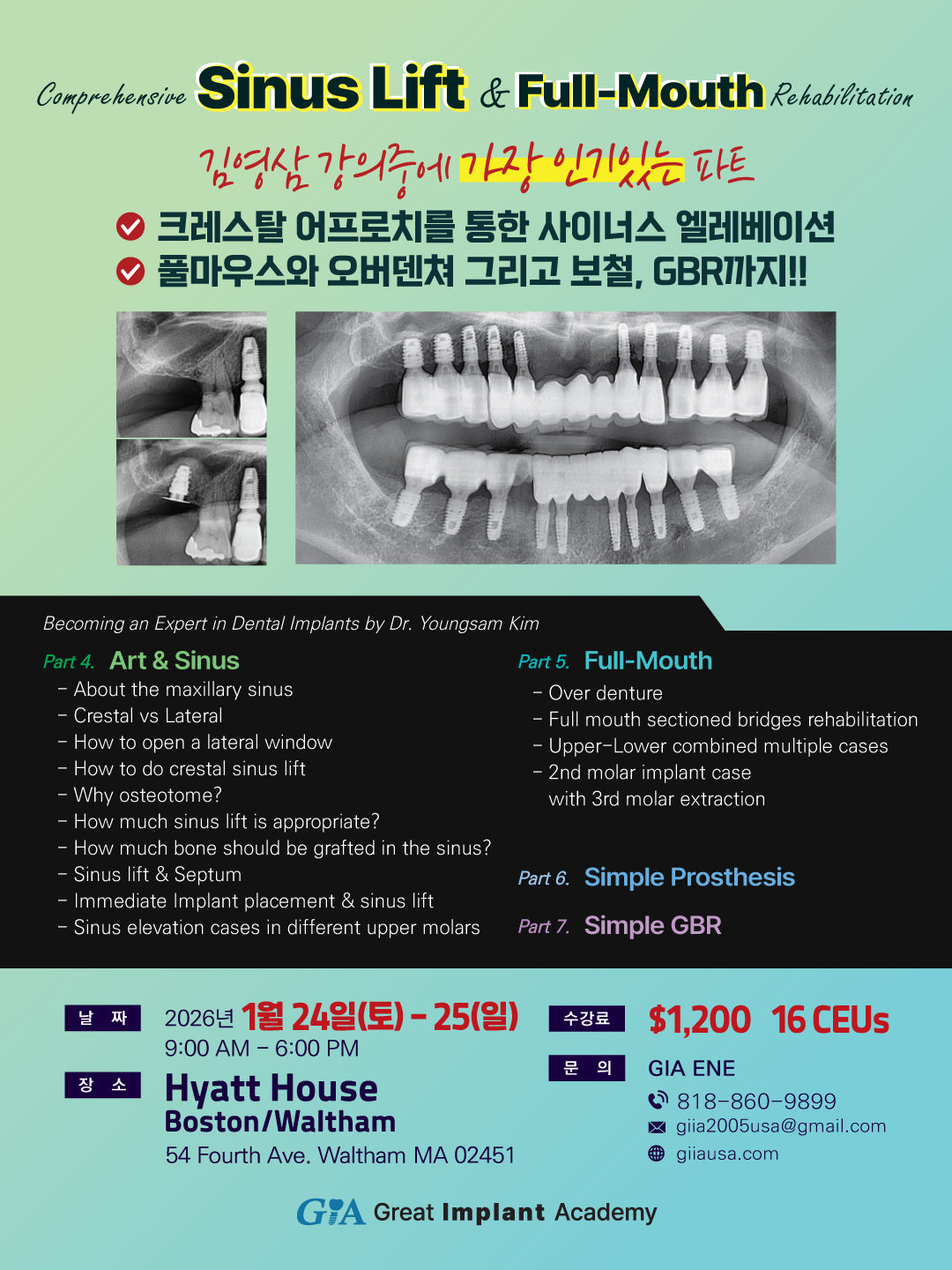 Boston) Comprehensive Sinus Lift & Full Mouth Rehabilitation