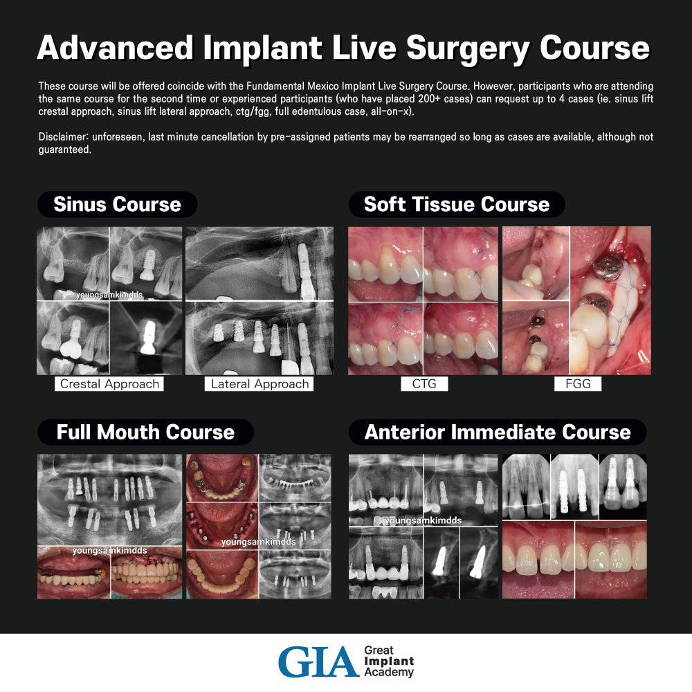 MEXICO LSC 2024 / November 20 - 24 [Implant Live Surgery Course]