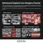 MEXICO LSC 2024 / Aug 29 - Sep 2 [Implant Live Surgery Course]