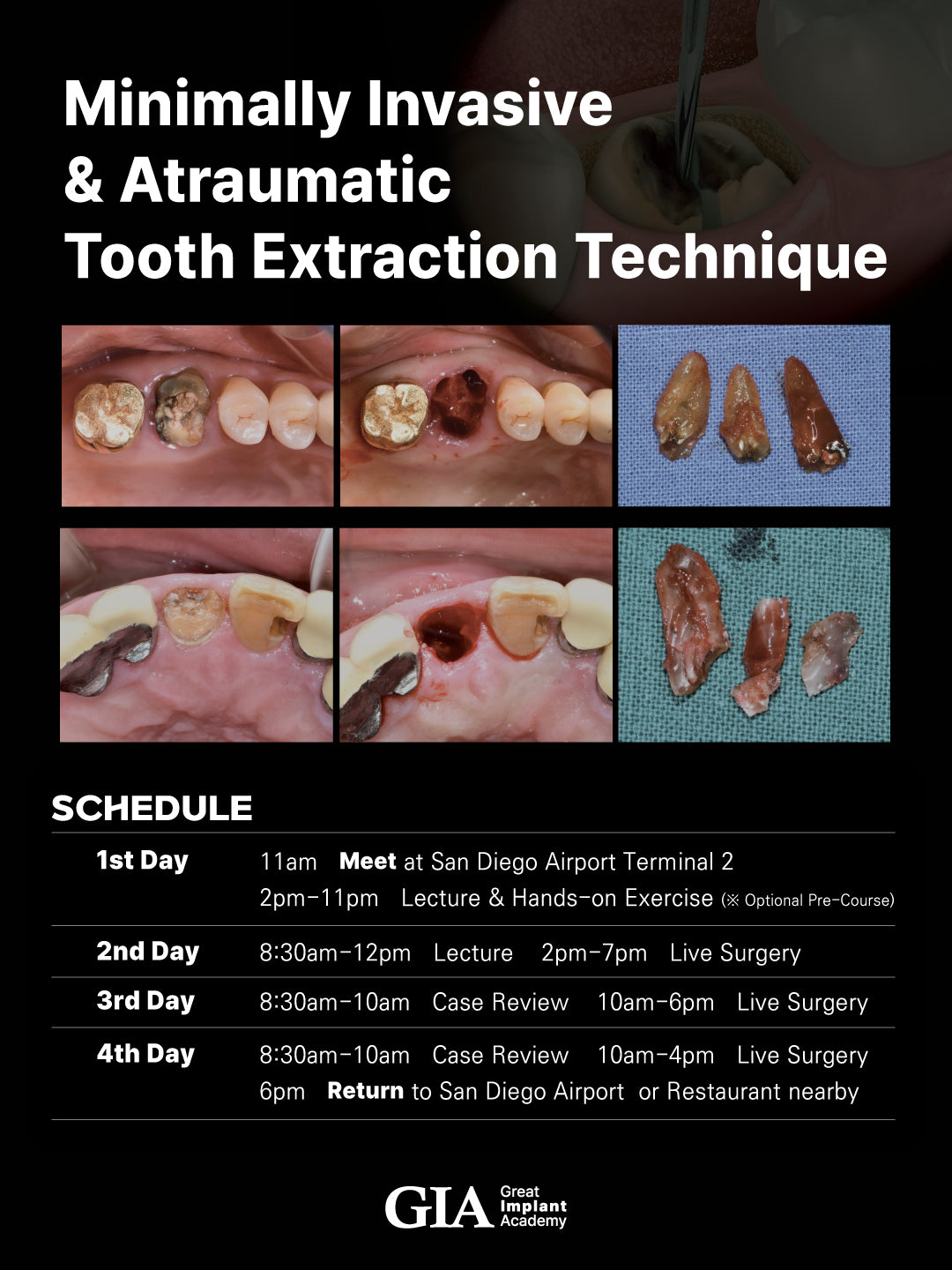 MEXICO LSC 2025 / Aug 29 - Sep 1 [Minimally Invasive Ext Live Surgery Course]