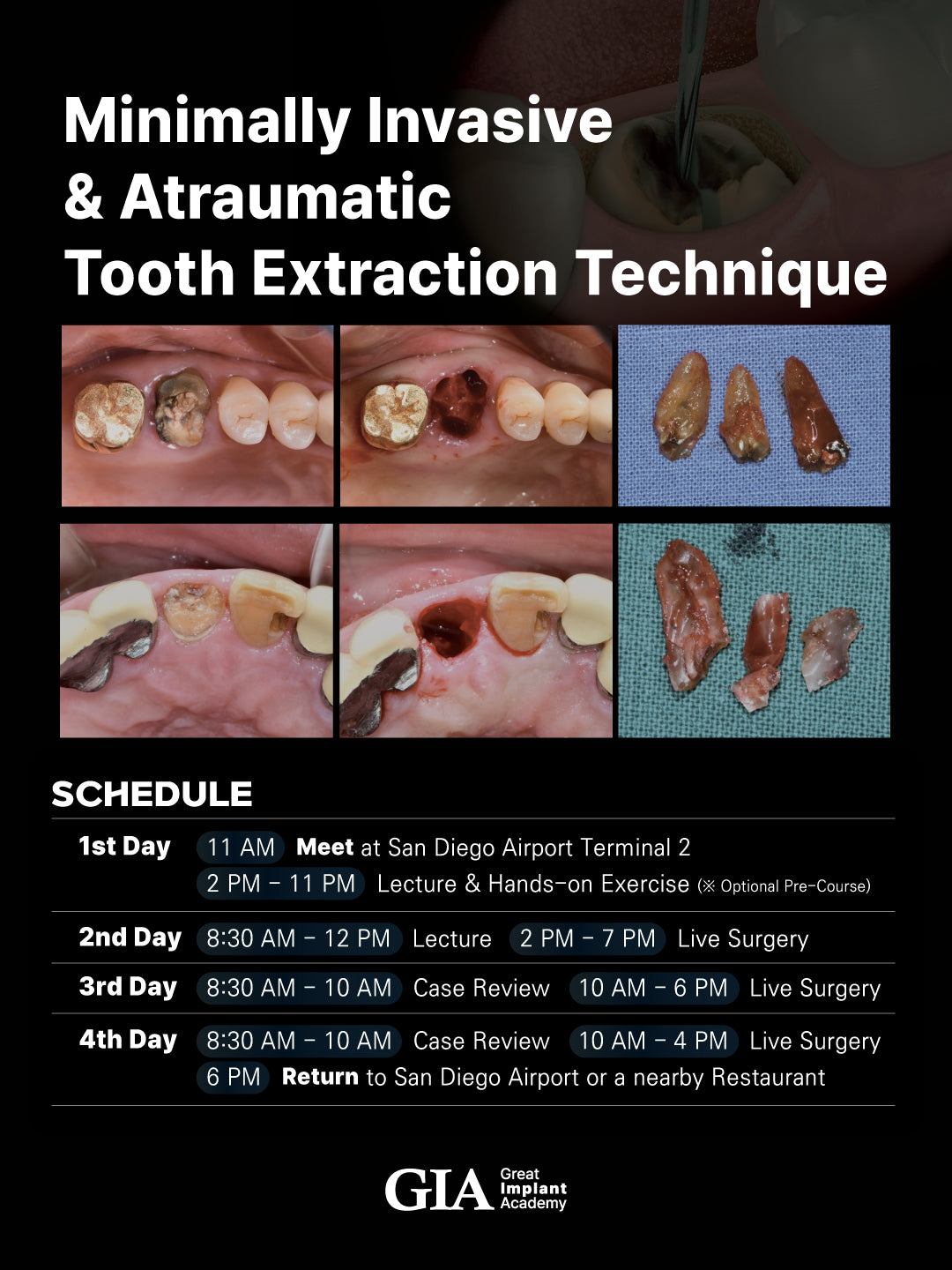 MEXICO LSC 2025 / July 3 - 6 [Minimally Invasive Ext Live Surgery Course]