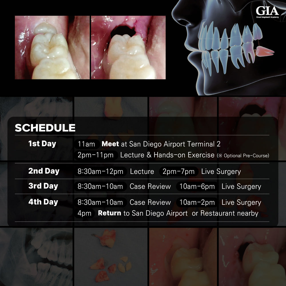 MEXICO LSC 2025 / January 24 - 27 [Third Molar Live Surgery Course]