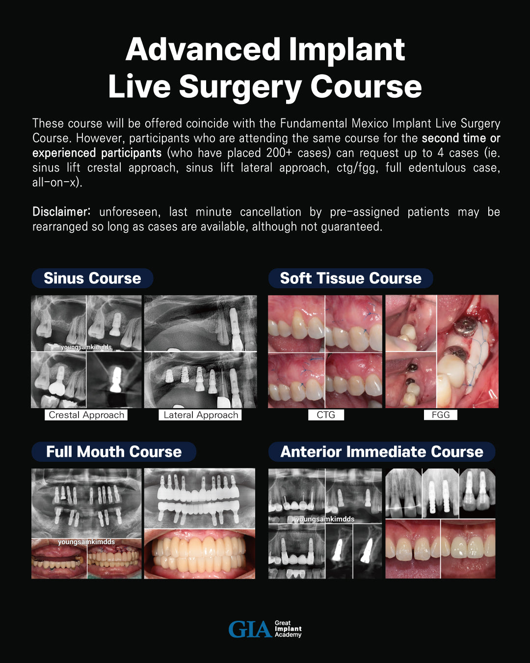 MEXICO LSC 2025 / October 8 - 12 [Implant Live Surgery Course]