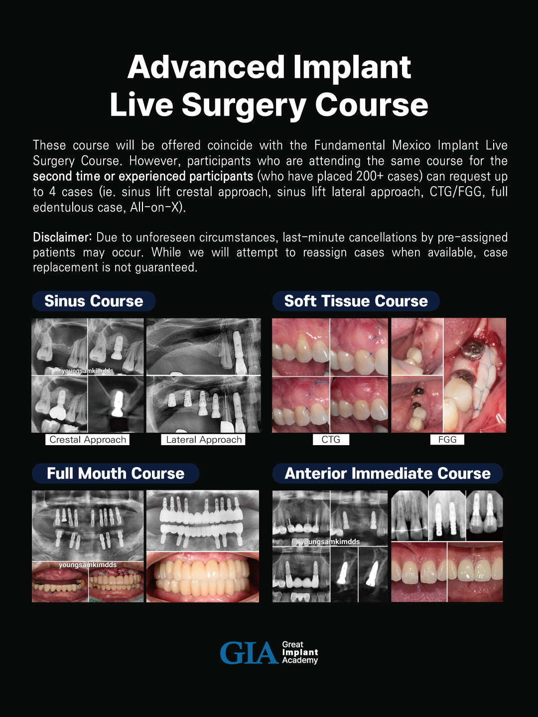 MEXICO LSC 2025 / July 2 - 6 [Implant Live Surgery Course]