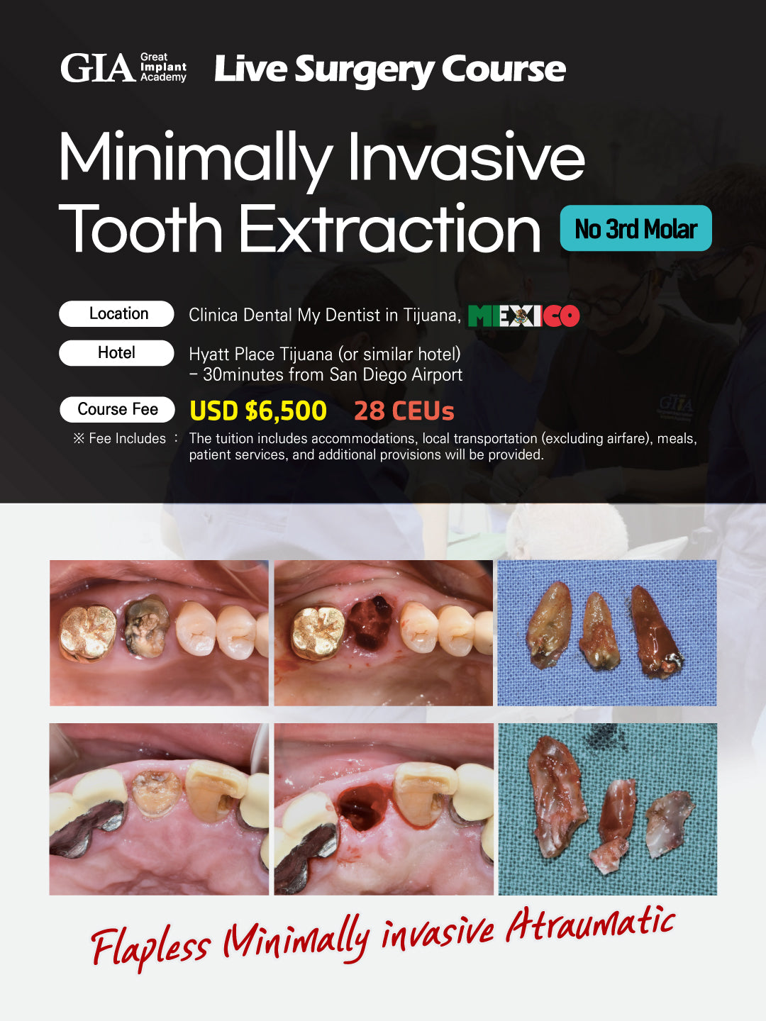 MEXICO LSC 2025 / Aug 29 - Sep 1 [Minimally Invasive Ext Live Surgery Course]