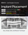 MEXICO LSC 2025 / October 8 - 12 [Implant Live Surgery Course]