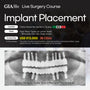 MEXICO LSC 2025 / March 19 - 23 [Implant Live Surgery Course]