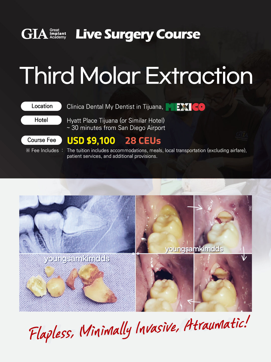MEXICO LSC 2025 / October 9 - 12 [Third Molar Live Surgery Course]