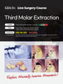 MEXICO LSC 2025 / October 9 - 12 [Third Molar Live Surgery Course]