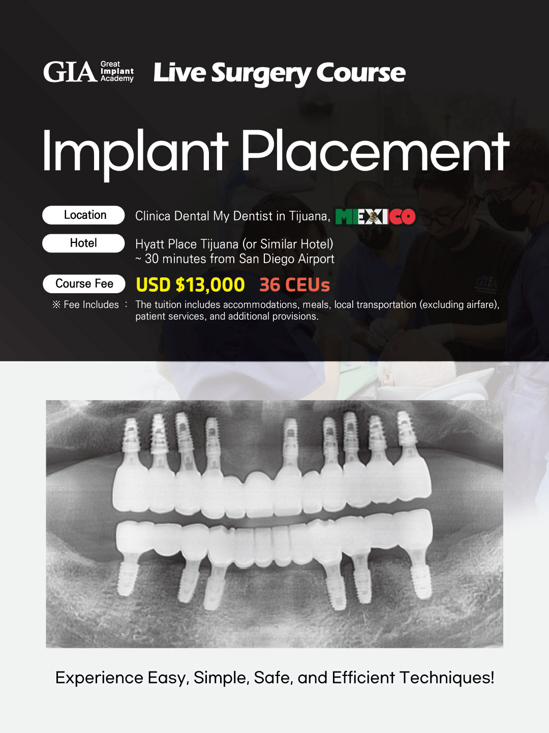 MEXICO LSC 2025 / July 2 - 6 [Implant Live Surgery Course]