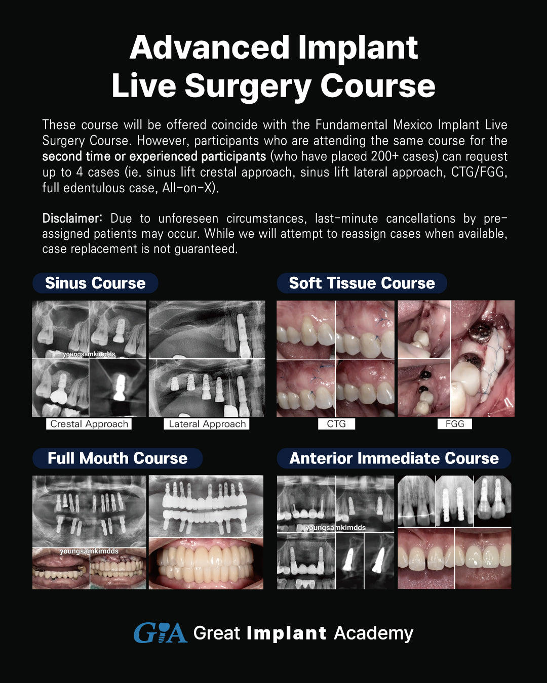 MEXICO LSC 2026 / November 12 - 16 [Implant Live Surgery Course]