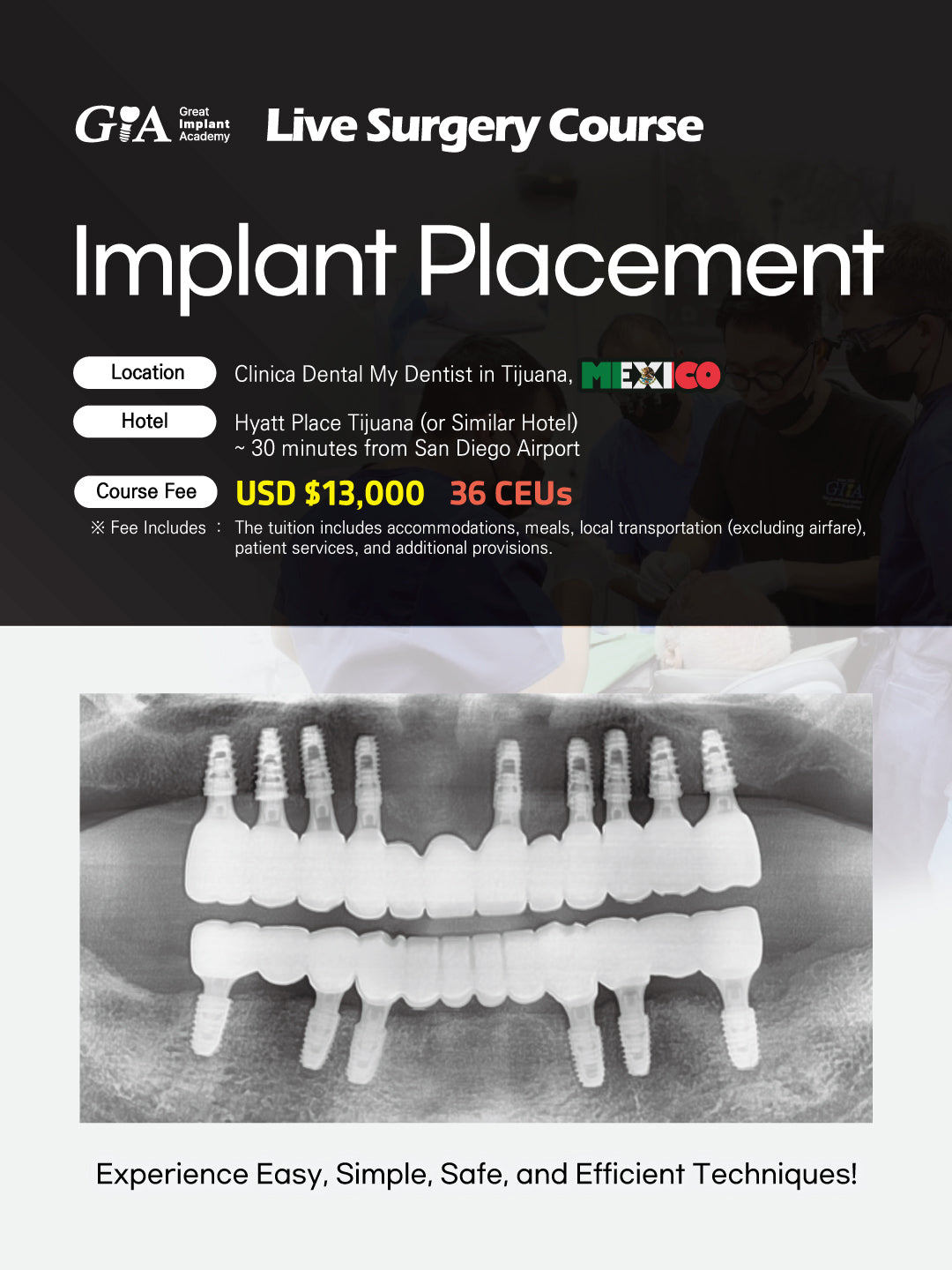MEXICO LSC 2026 / February 4 - 8 [Implant Live Surgery Course]