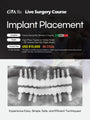 MEXICO LSC 2026 / February 4 - 8 [Implant Live Surgery Course]