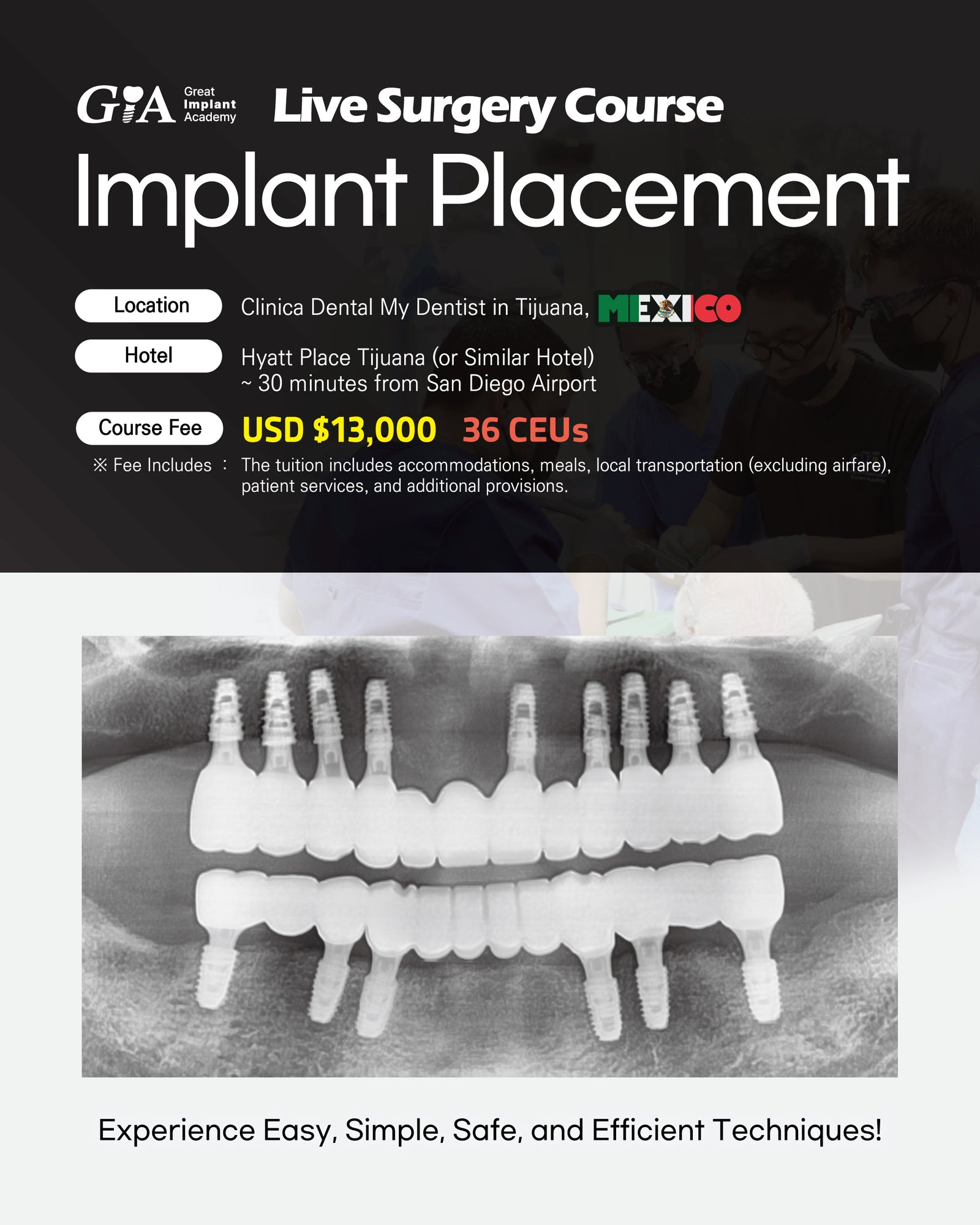 MEXICO LSC 2026 / November 12 - 16 [Implant Live Surgery Course]