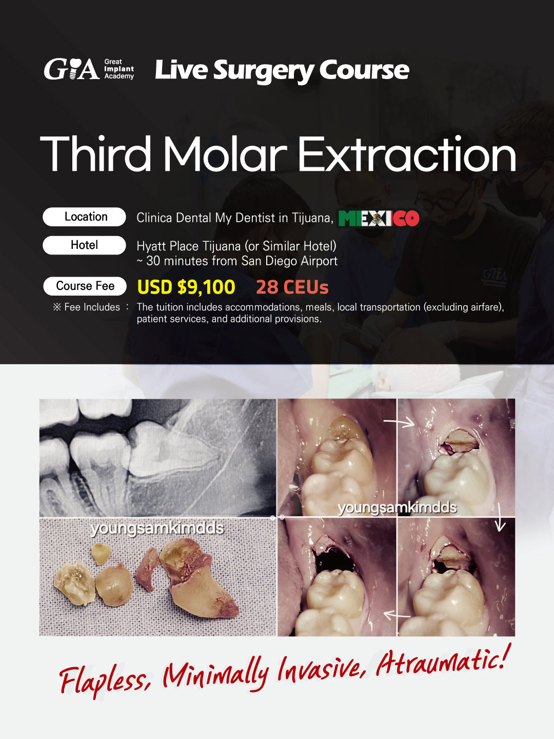 MEXICO LSC 2026 / February 5 - 8 [Third Molar Live Surgery Course]