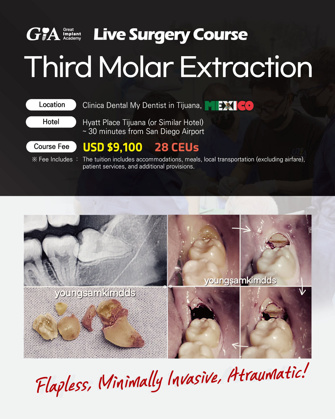 MEXICO LSC 2026 / November 13 - 16 [Third Molar Live Surgery Course]