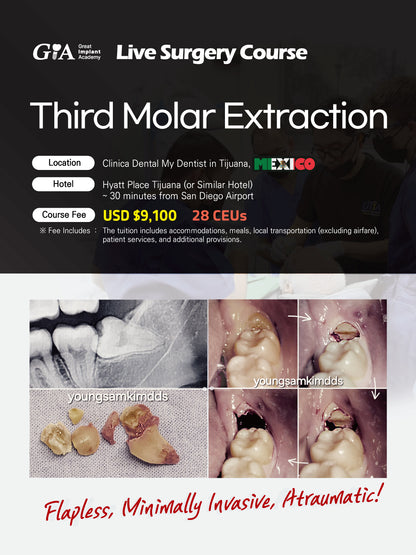 MEXICO LSC 2026 / April 24 - 27 [Third Molar Live Surgery Course]