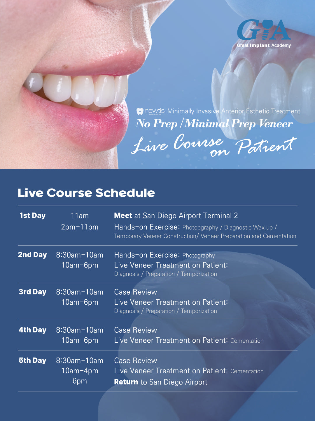 MEXICO VENEER LC 2026: July 8 - 12 [No Prep / Minimal Prep Veneer Live Course on Patient]
