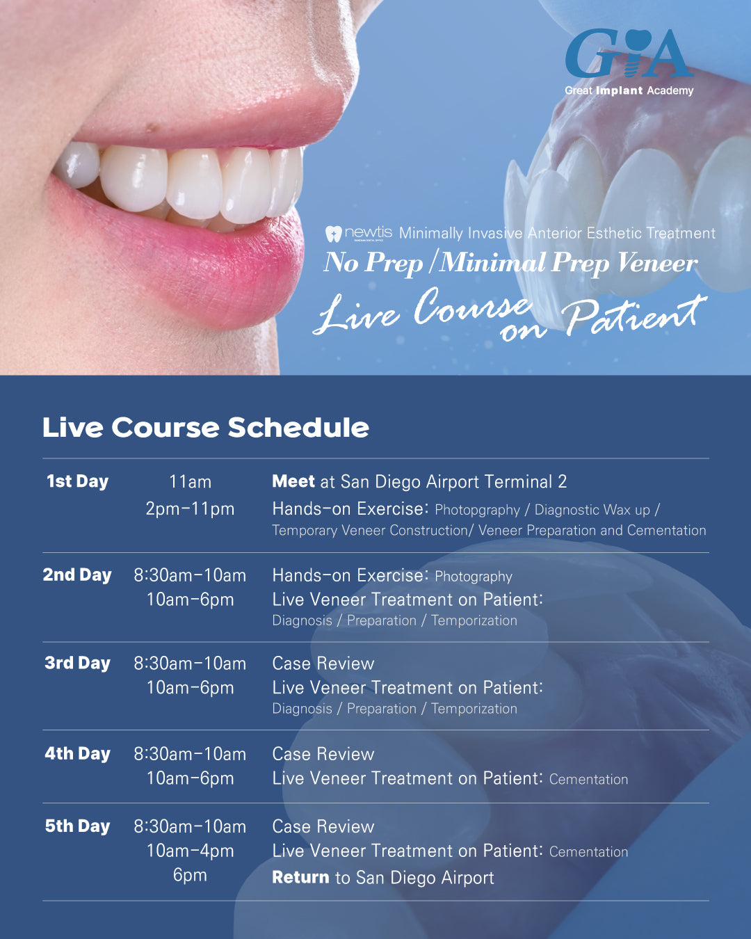 MEXICO VENEER LC 2026: July 8 - 12 [No Prep / Minimal Prep Veneer Live Course on Patient]