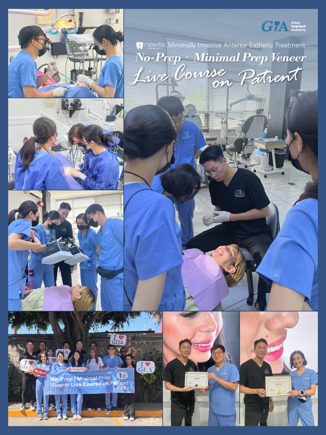 MEXICO VENEER LC 2026: July 8 - 12 [No Prep / Minimal Prep Veneer Live Course on Patient]