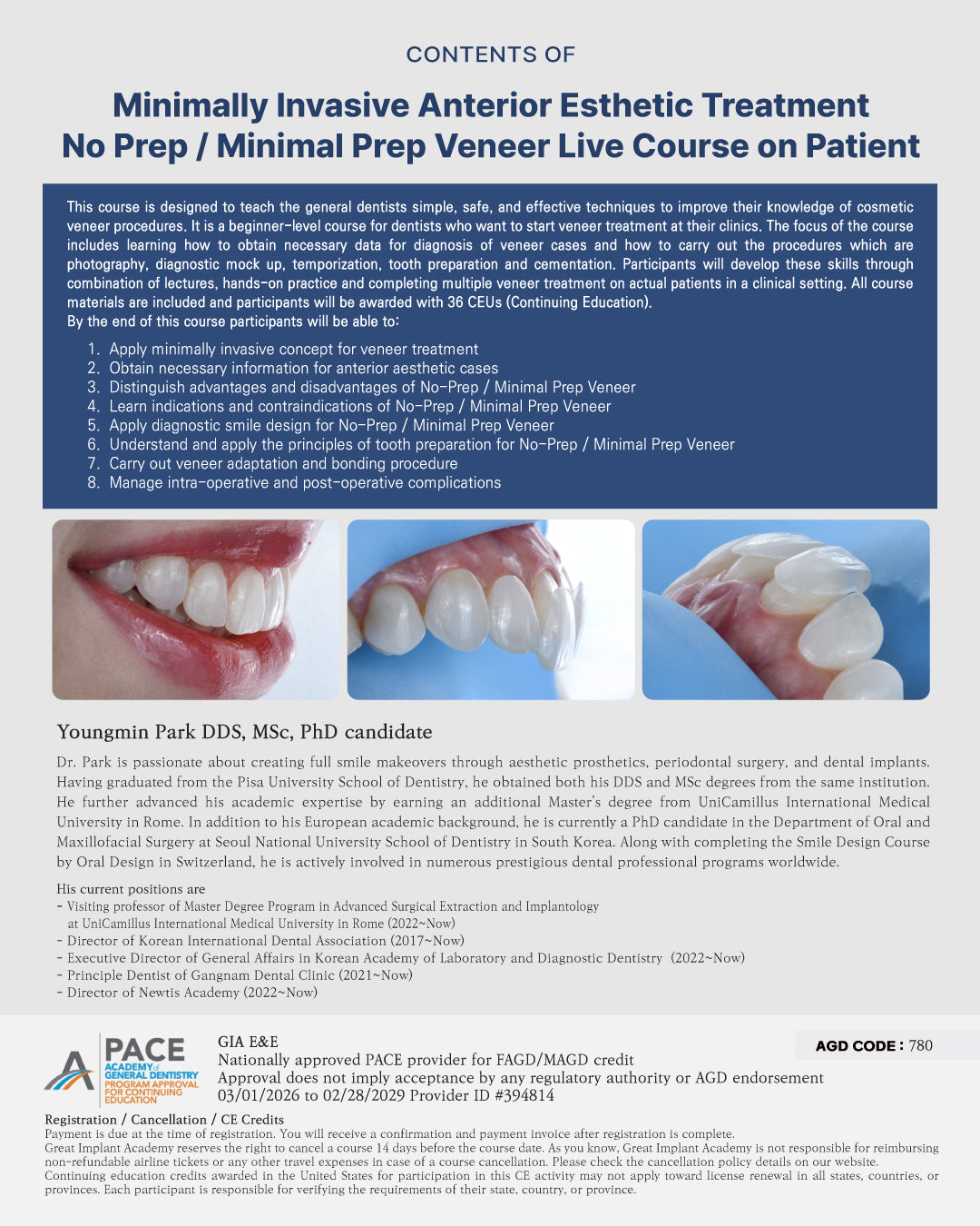 MEXICO VENEER LC 2026: July 8 - 12 [No Prep / Minimal Prep Veneer Live Course on Patient]