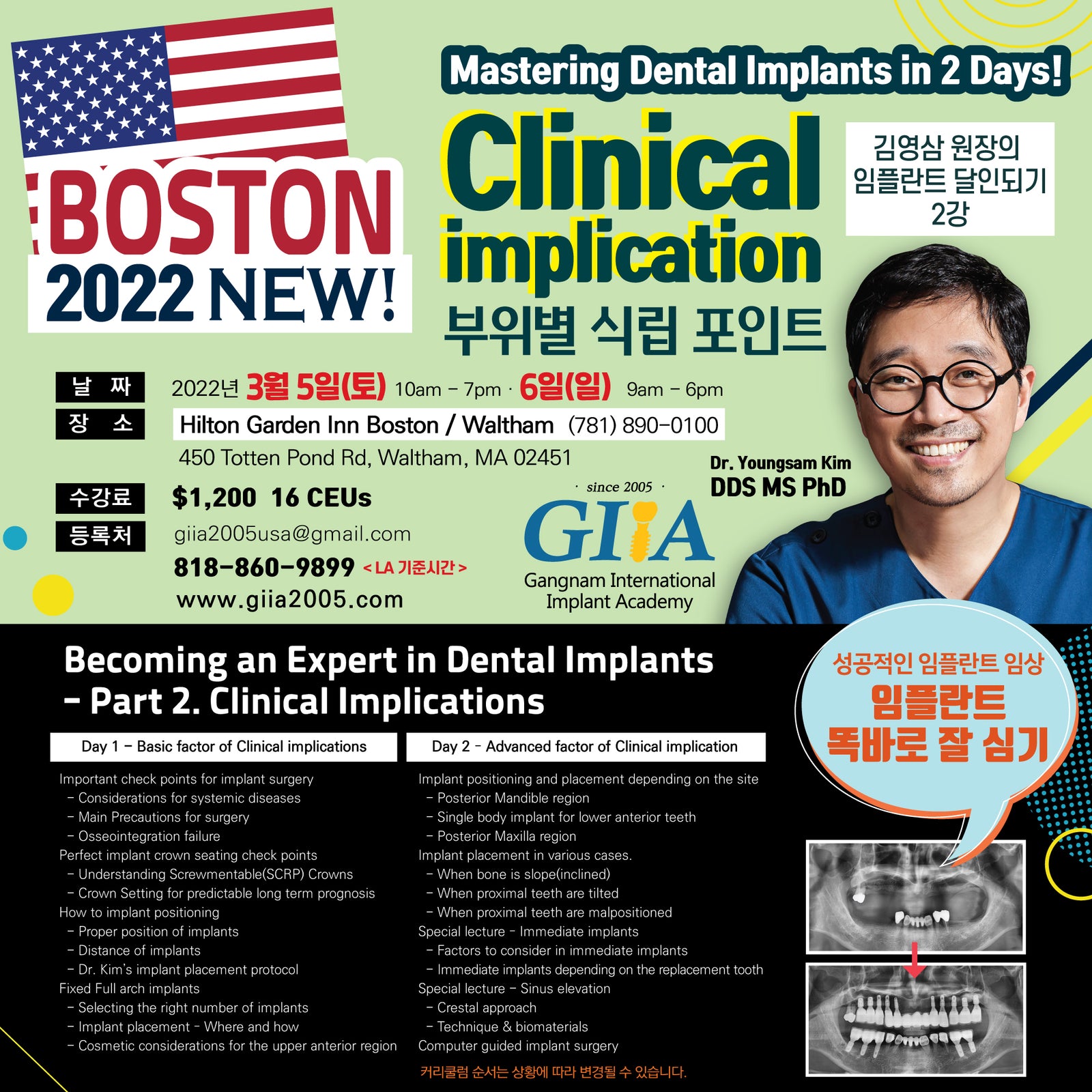 Boston) Clinical Implication- Mastering Dental Implants [2022/3/5 ~ 3/6]