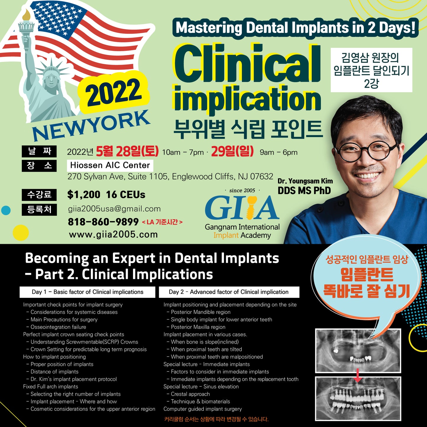 New York) Clinical Implication- Mastering Dental Implants [2022/5/28 ~ 5/29]