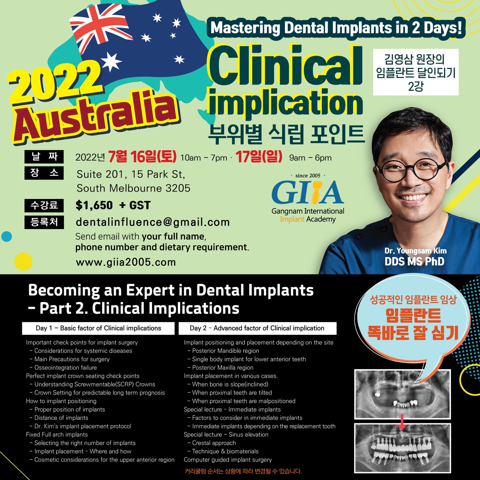 Melbourne, Australia) Clinical Implication- Mastering Dental Implants [2022/7/16 ~ 7/17]