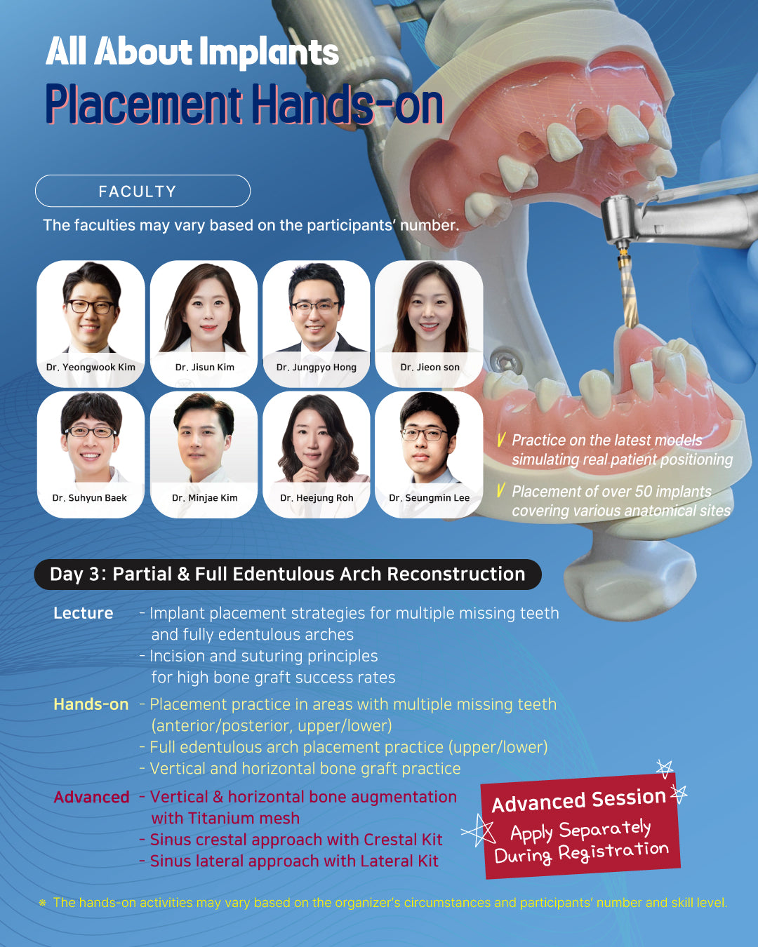 KOREA) All About Implants Hands-on Workshop [2026/4/17 ~ 4/19]