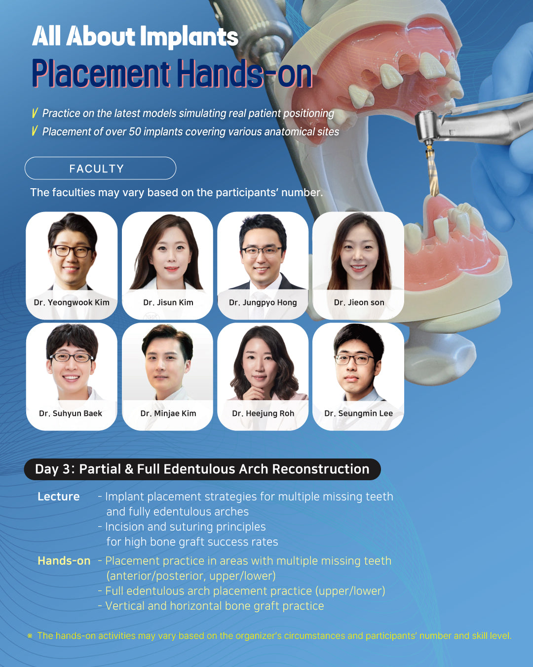 KOREA) All About Implants Hands-on Workshop [2026/7/31 ~ 8/2]