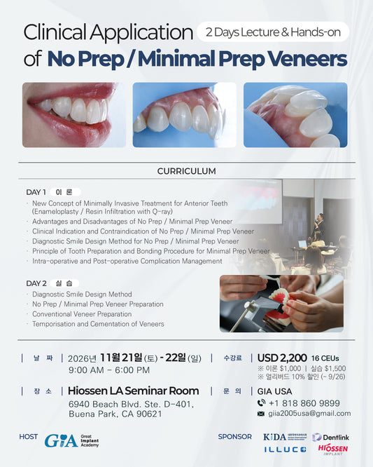 Los Angeles) No Prep / Minimal Prep Veneers: Clinical Application Lecture & Hands-on