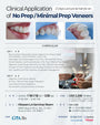 Los Angeles) No Prep / Minimal Prep Veneers: Clinical Application Lecture & Hands-on