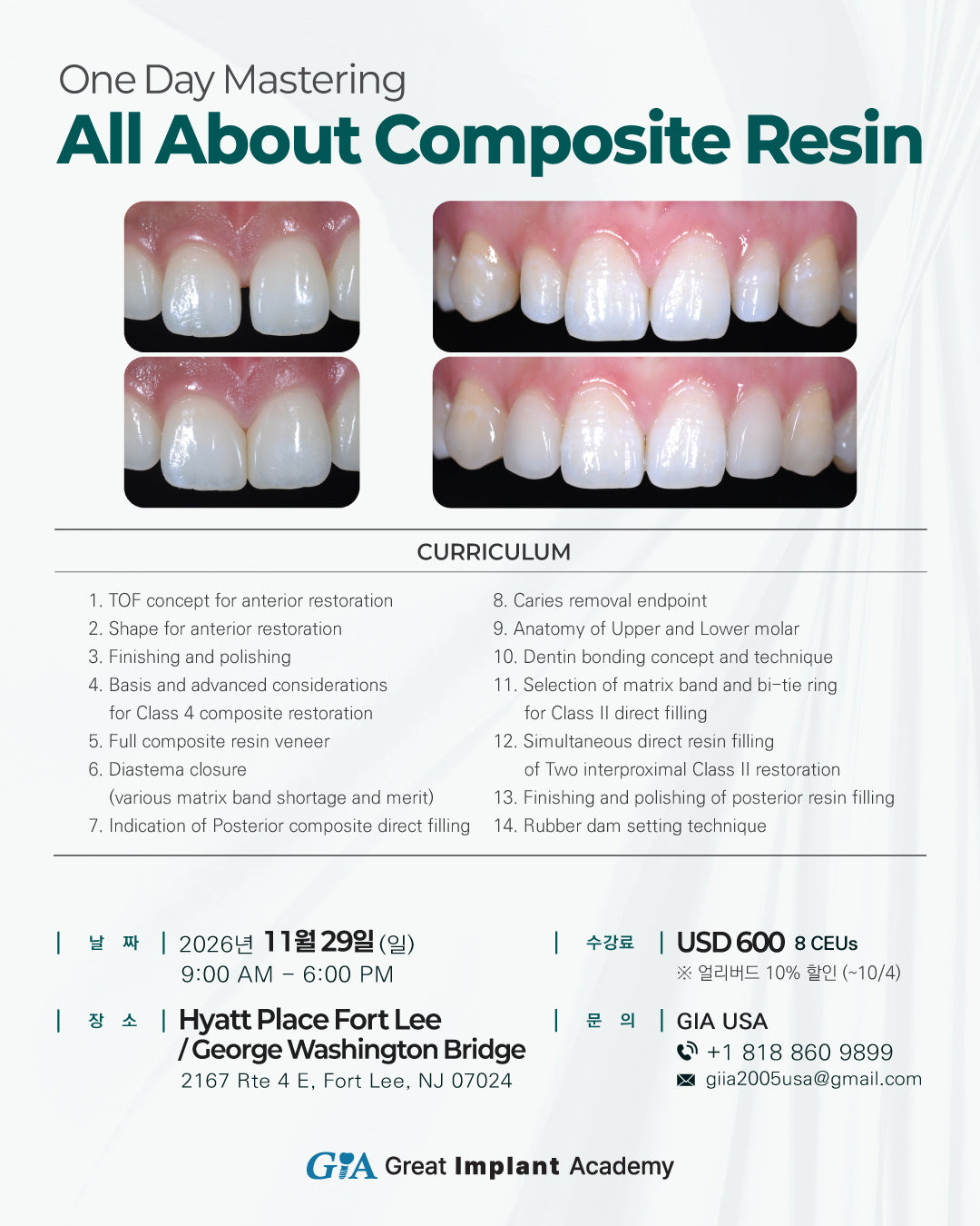 New York) All About Composite Resin One Day Mastring