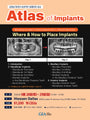 Dallas) Atlas of Implants [25/6/28 ~ 6/29]