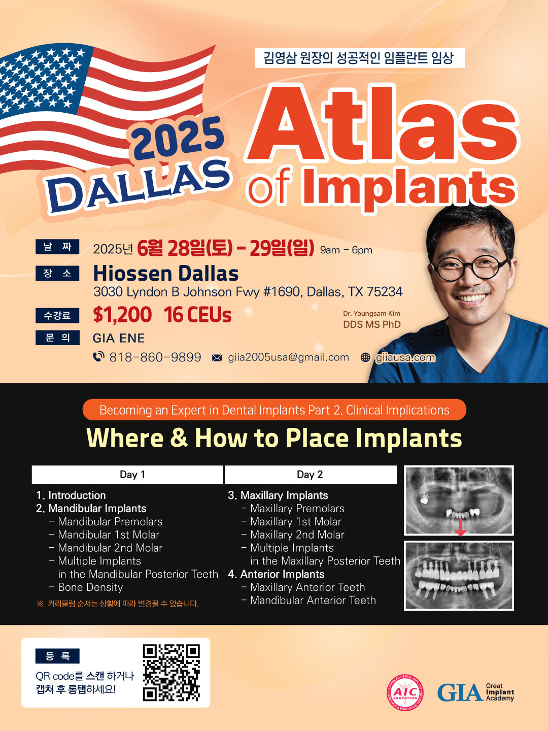 Dallas) Atlas of Implants [25/6/28 ~ 6/29]