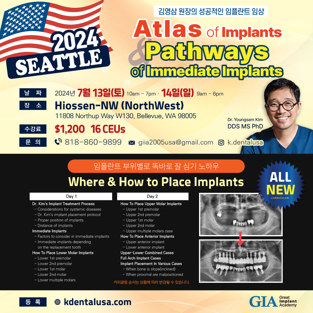 Seattle) Atlas of Implants & Pathways of Immediate Implants [24/7/13 ~ 7/14]
