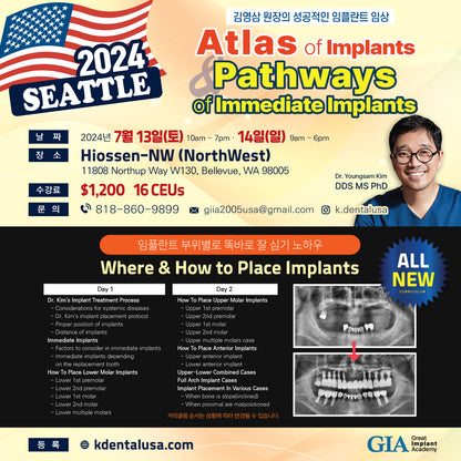 Seattle) Atlas of Implants & Pathways of Immediate Implants [24/7/13 ~ 7/14]