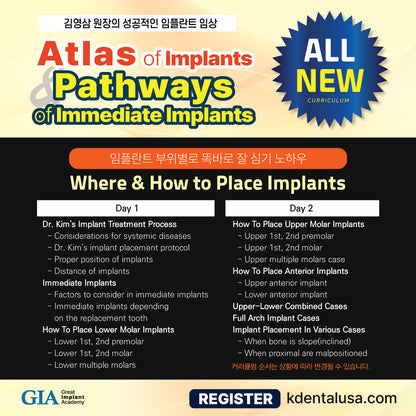 Seattle) Atlas of Implants & Pathways of Immediate Implants [24/7/13 ~ 7/14]