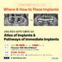 Seattle) Atlas of Implants & Pathways of Immediate Implants