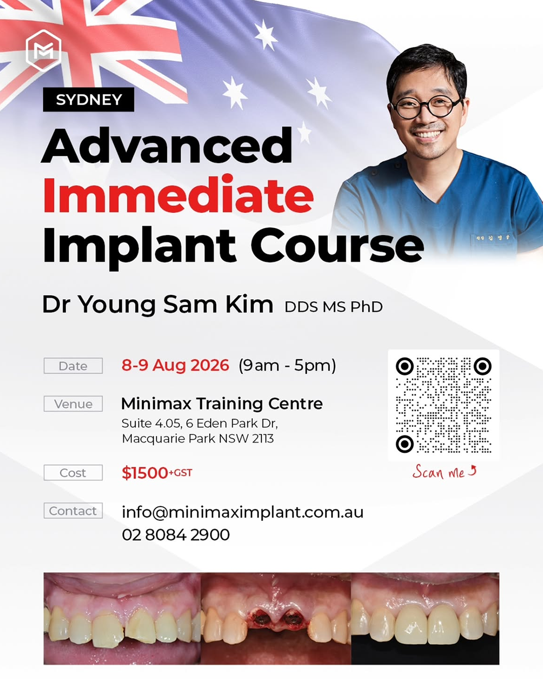 Sydney, Australia) Advanced Immediate Implant Hands-on Course [2026/8/10]