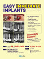Boston) Easy Immediate Implant