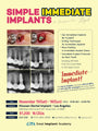 Los Angeles) Simple Immediate Implants