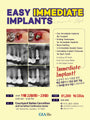 Dallas) Easy Immediate Implants