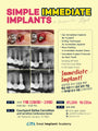 Dallas) Simple Immediate Implants