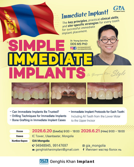 Mongolia) Simple Immediate Implants [2026/6/20 ~ 6/21]