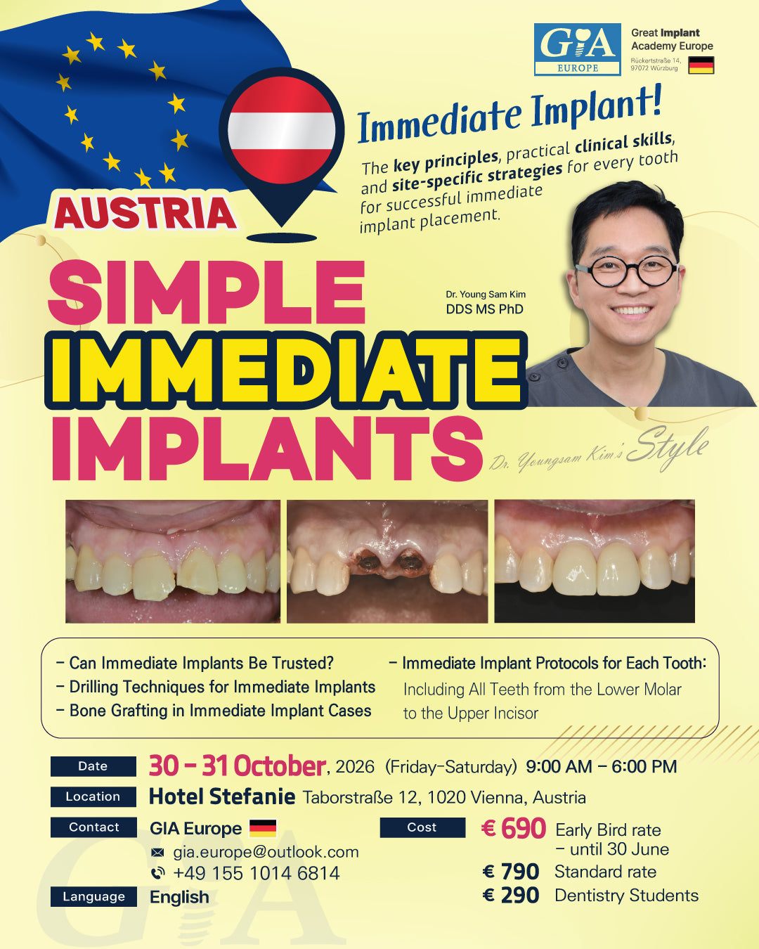 Austria) Simple Immediate Implants [2026/10/30 ~ 10/31]