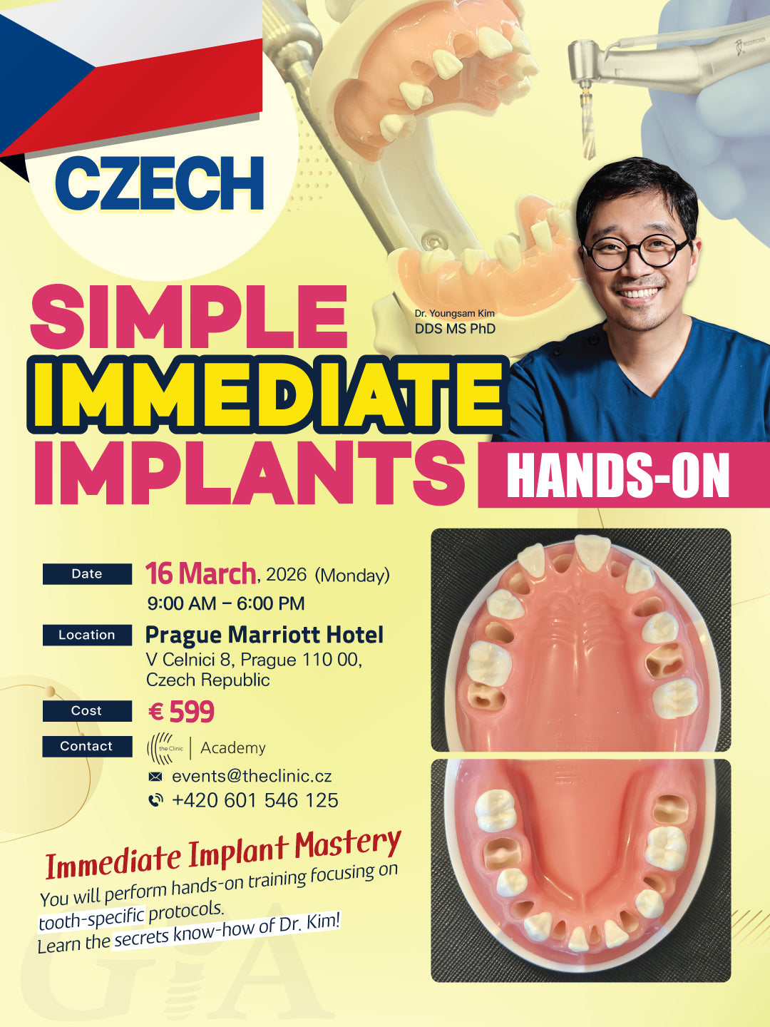 Czech) Simple Immediate Implants Hands-on [2026/3/16]