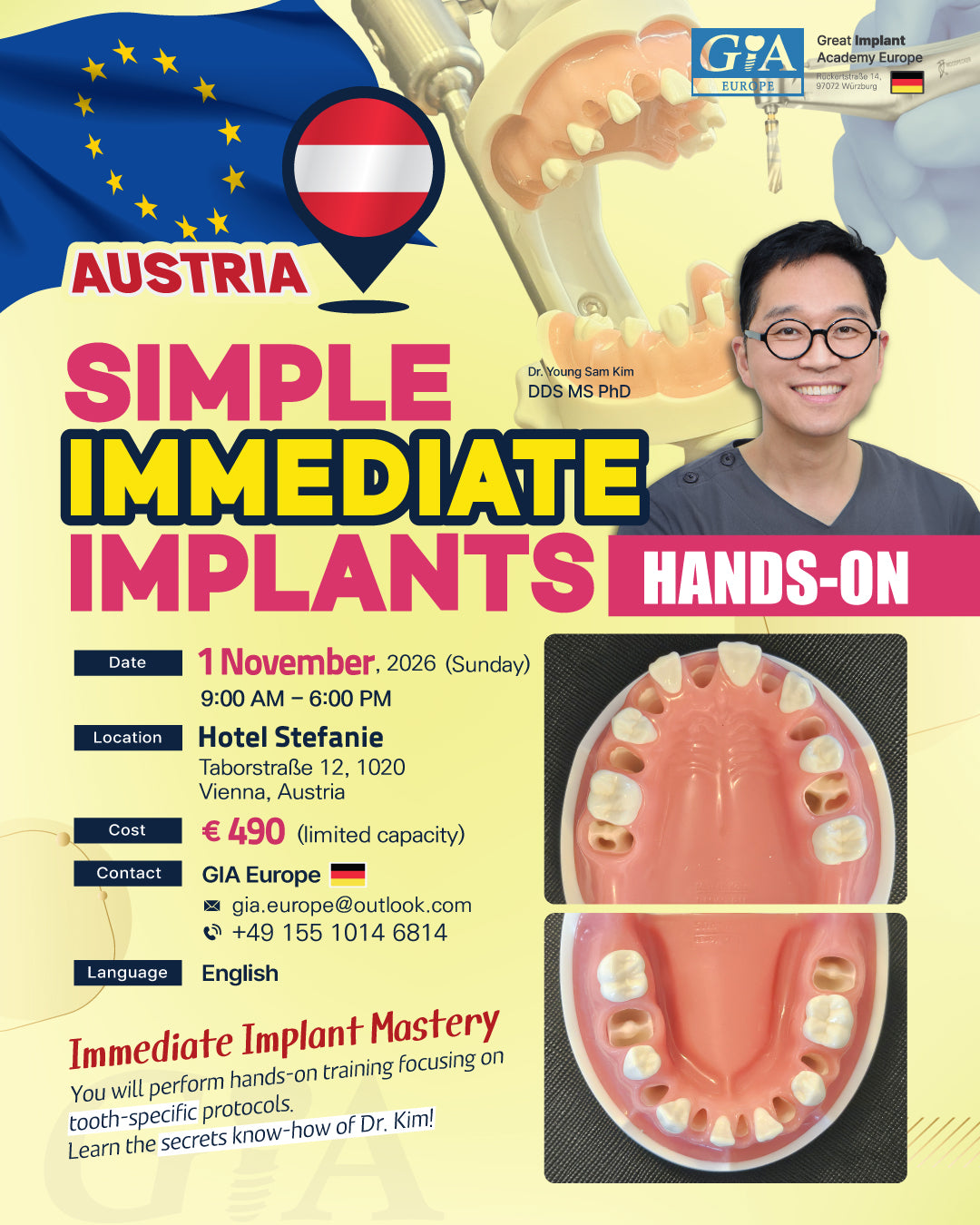 Austria) Simple Immediate Implants Hands-on [2026/11/1]